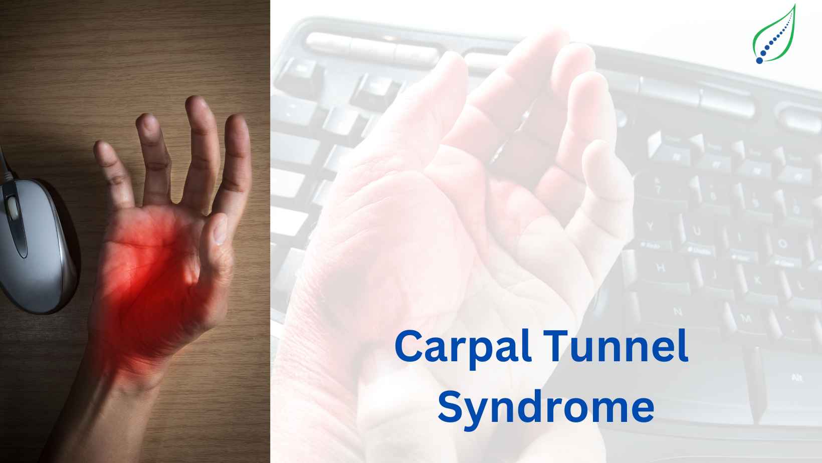 Carpal Tunnel Syndrome